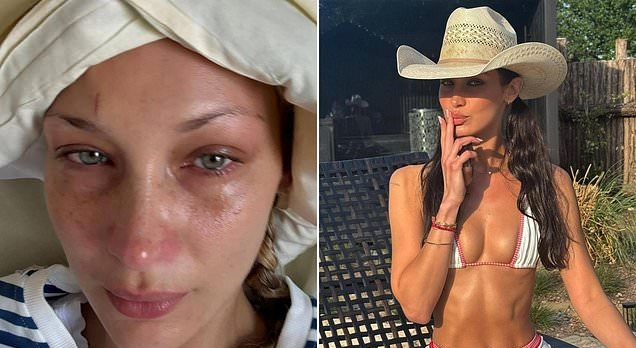 Bella Hadid Depression and Business Empire Exposed Exclusive CEO Today Interview