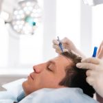 Understanding Hair Transplantation