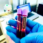 Stem Cell Therapy and the Future of Regenerative Medicine