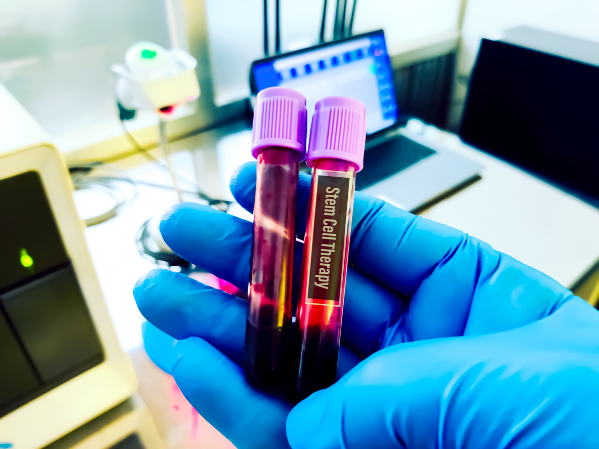 biological specimen for cell therapy testing.