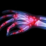 Defining Rheumatology